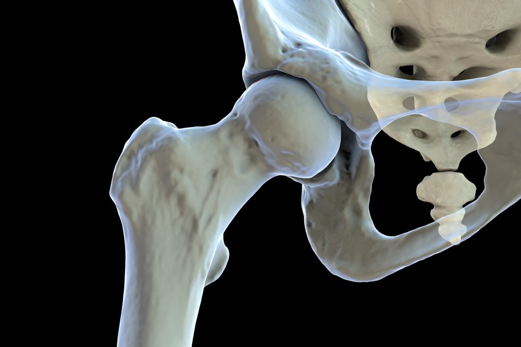 schemat anatomii stawu biodrowego - głowa kości udowej, panewka, obrąbek stawowy, chrząstka